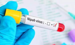 Second suspected Nipah death in Kerala; tracing, ...